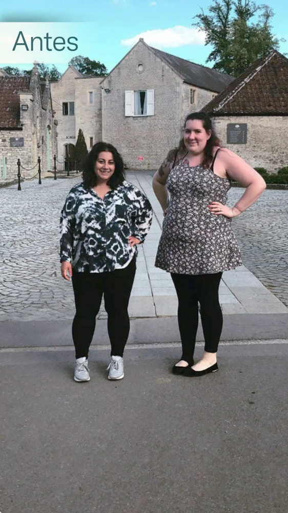 RESULTADOS ANTES DE BALÓN GÁSTRICO ALLURION