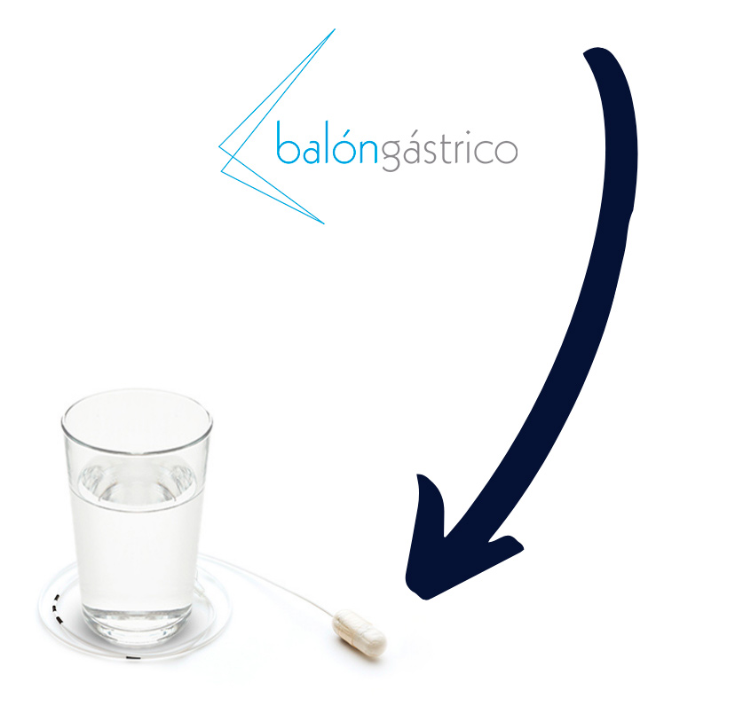NUEVA TECNO-MEDICA-BALON-ALLURIONbalon_1